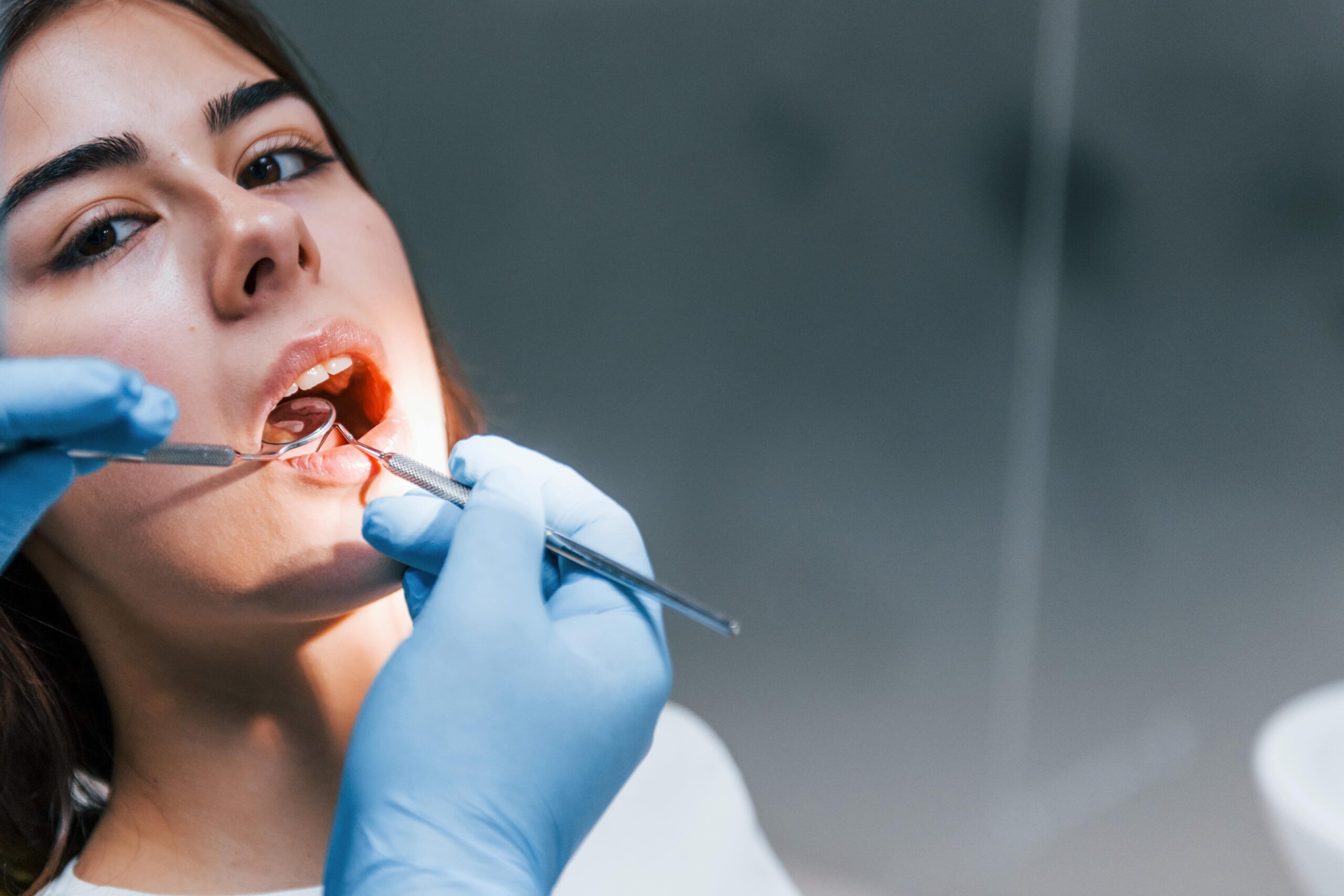 Signs You Might Need a Root Canal
